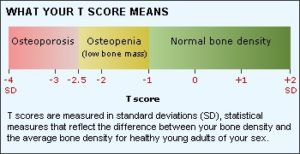 icd 10 code for dexa bone density axial