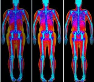 Body Composition Scan
