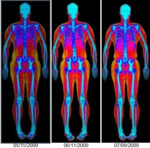 Body Composition Scan