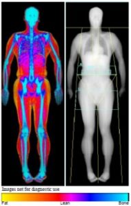 Body Composition Scan - Peninsula Imaging